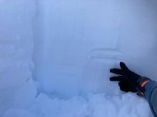 7200' on N aspect:  Rain crust above thumb, index finger pointing to reactive buried surface hoar.